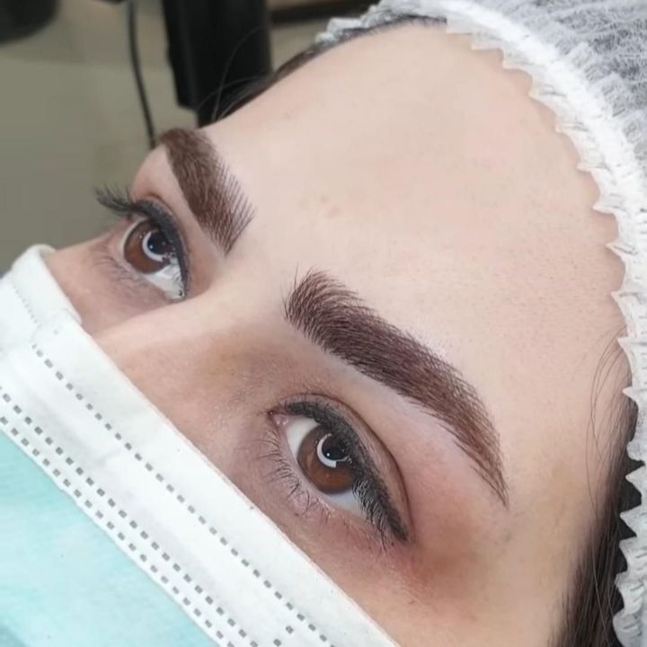 میکروبلیدینگ ابرو برای فرم‌دهی به ابروهای کم‌پشت در ساناز بیوتی